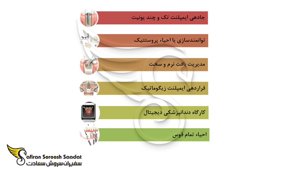 مباحث تحصیل ایمپلنت 3 سطحی در آمریکا