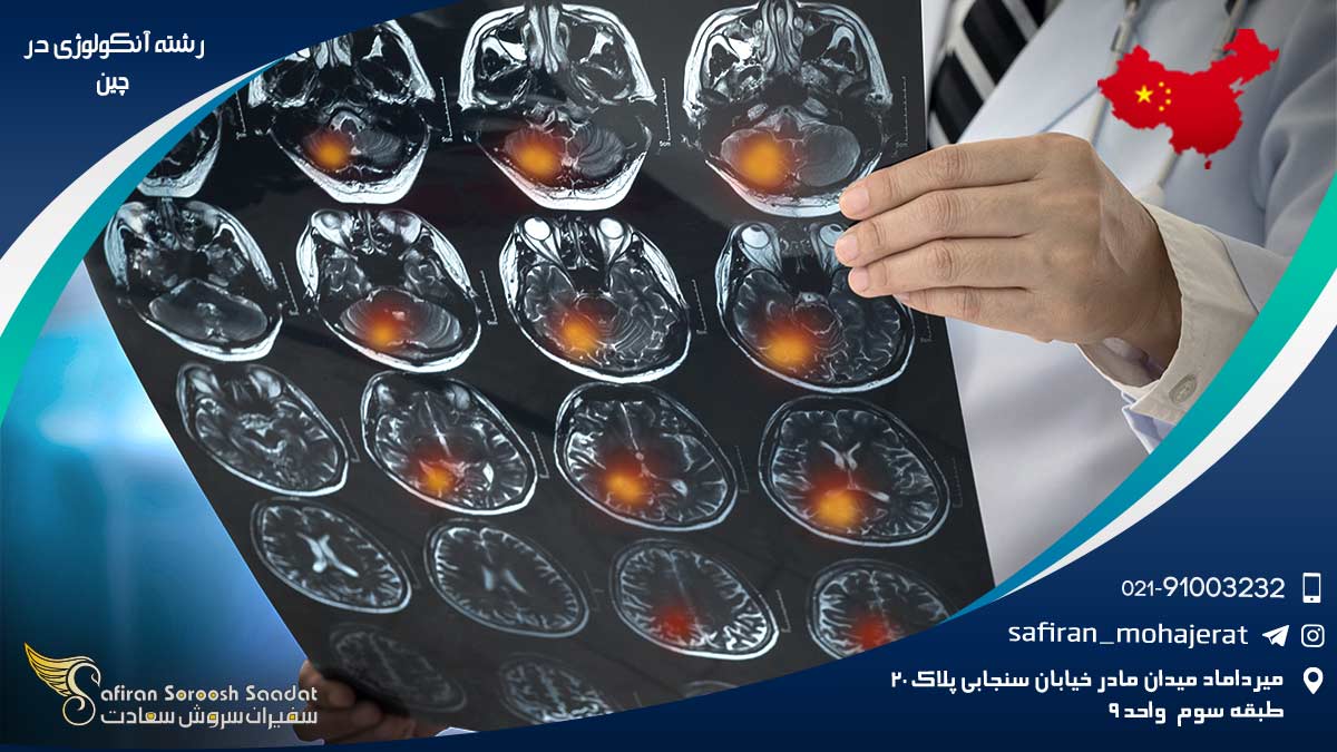 رشته آنکولوژی در چین