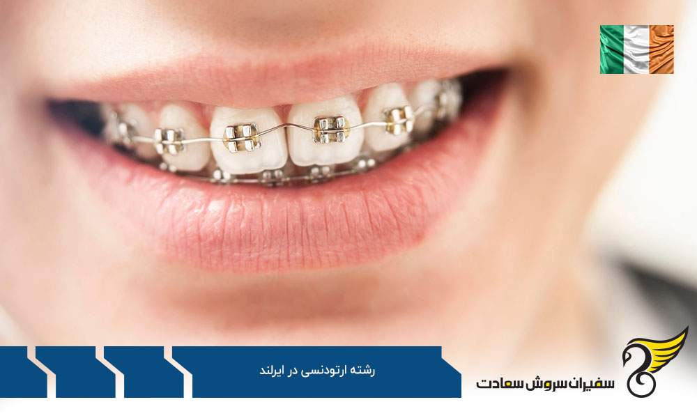هزینه تحصیل رشته ارتودنسی در ایرلند