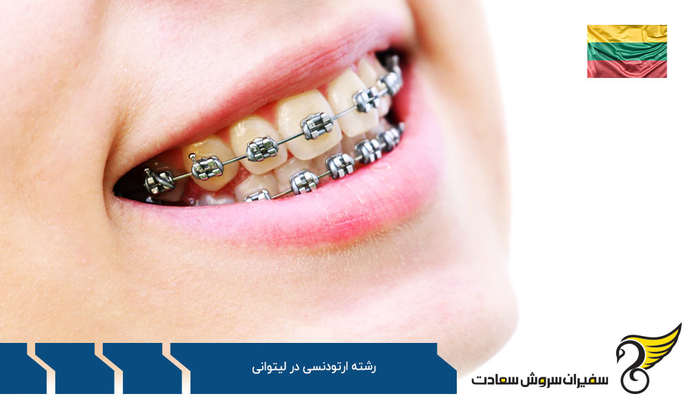 اخذ ویزا برای تحصیل در رشته ارتودنسی در لیتوانی