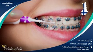 رشته ارتودنسی در فنلاند