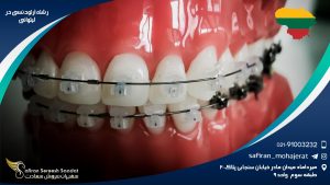 رشته ارتودنسی در لیتوانی