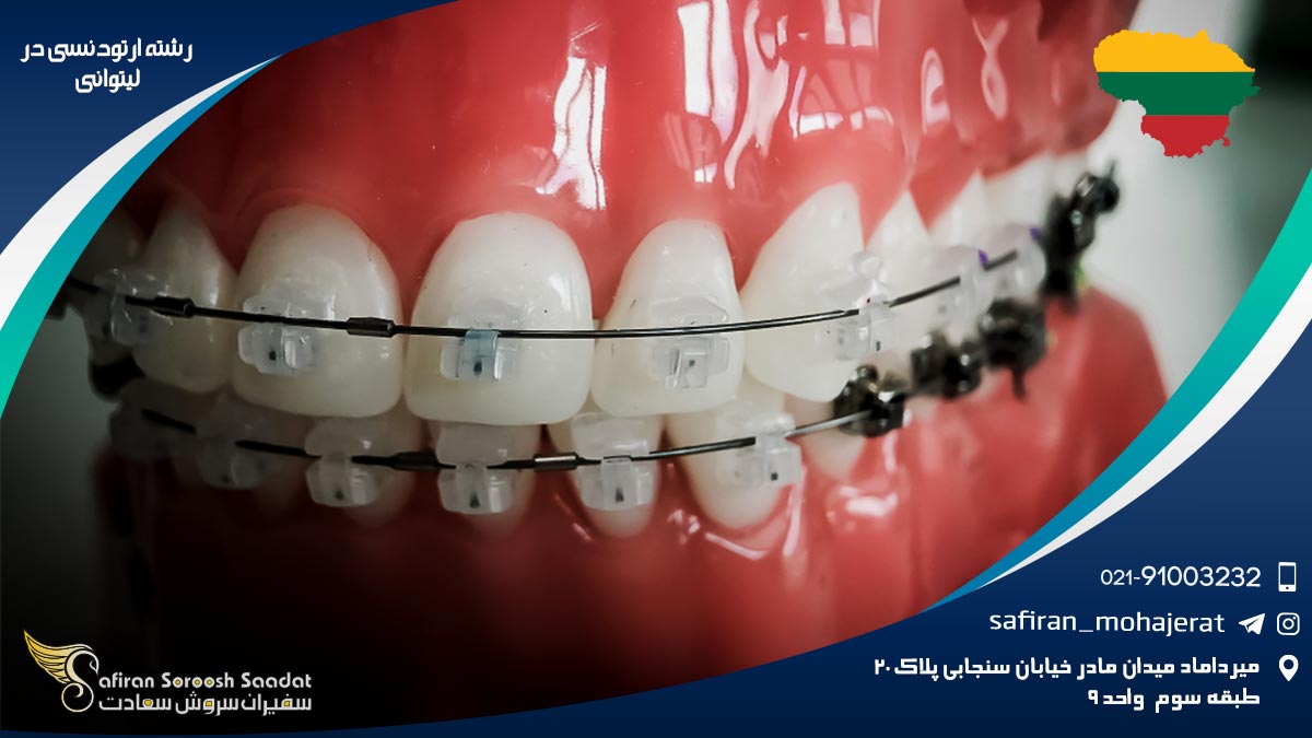 رشته ارتودنسی در لیتوانی