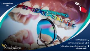 رشته ارتودنسی در مالتا