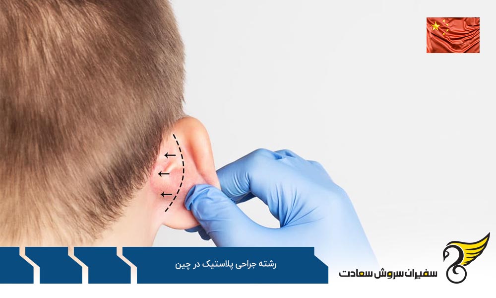 شرایط تحصیل رشته جراحی پلاستیک در چین
