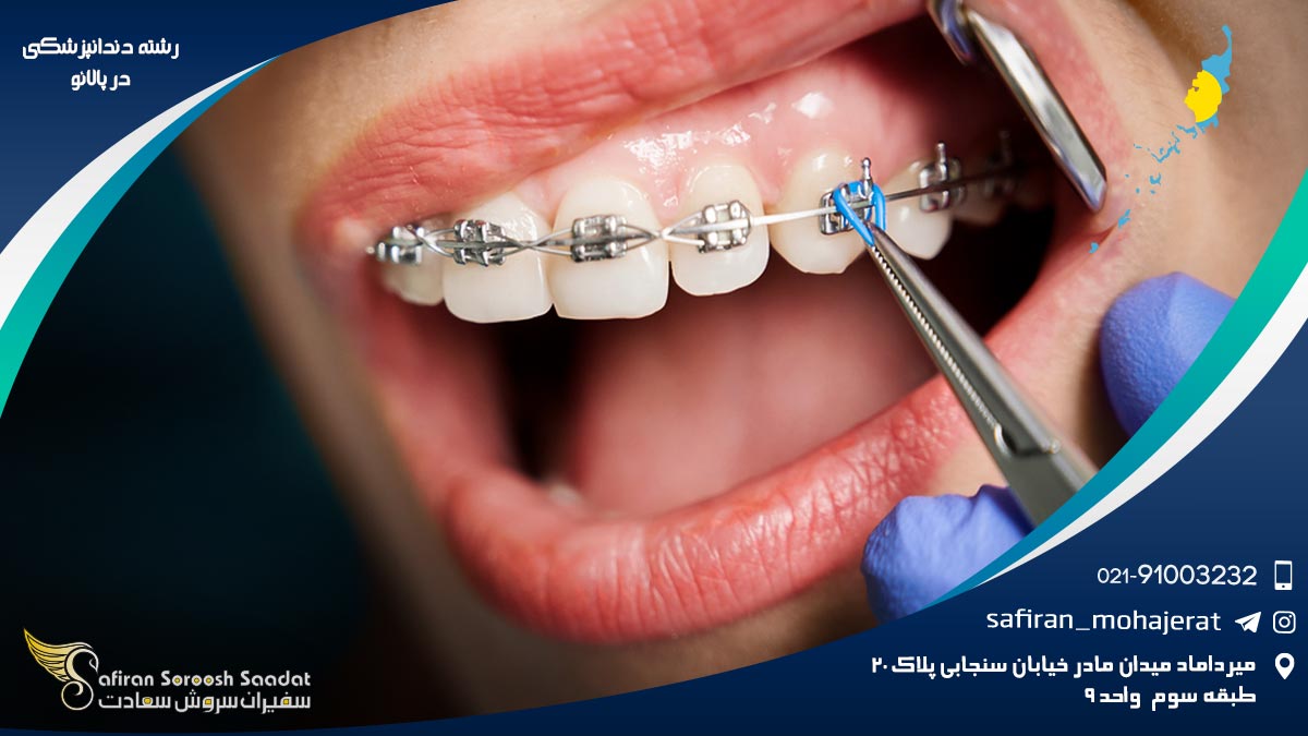 رشته دندانپزشکی در پالائو