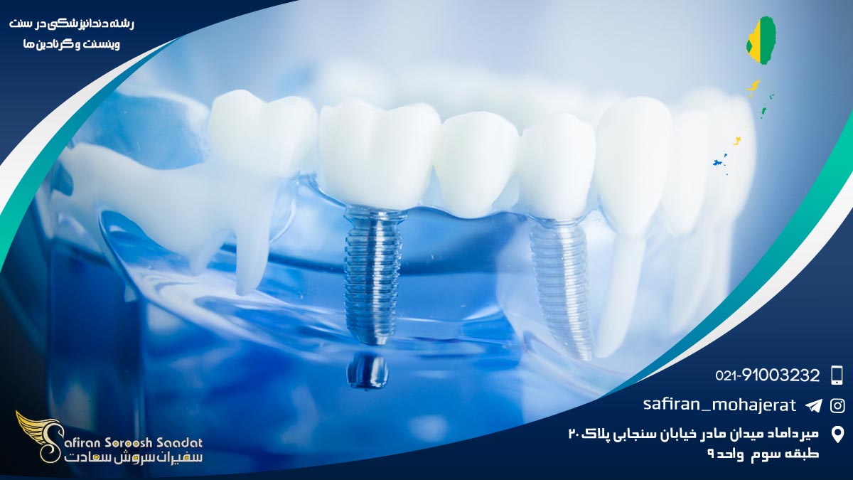 رشته دندانپزشکی در سنت وینسنت و گرنادین ها