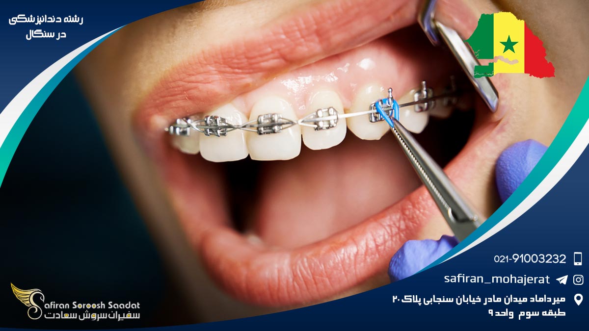 رشته دندانپزشکی در سنگال