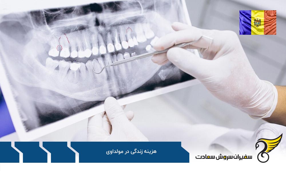 بررسی وضعیت هزینه های زندگی در مولداوی
